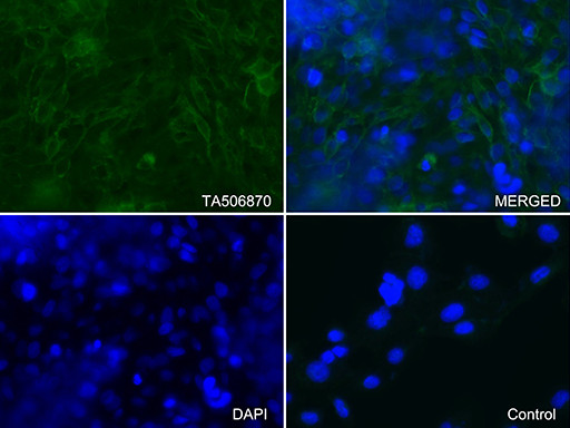 ICAM1 Antibody in Immunocytochemistry (ICC/IF)