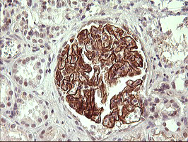 ICAM1 Antibody in Immunohistochemistry (Paraffin) (IHC (P))