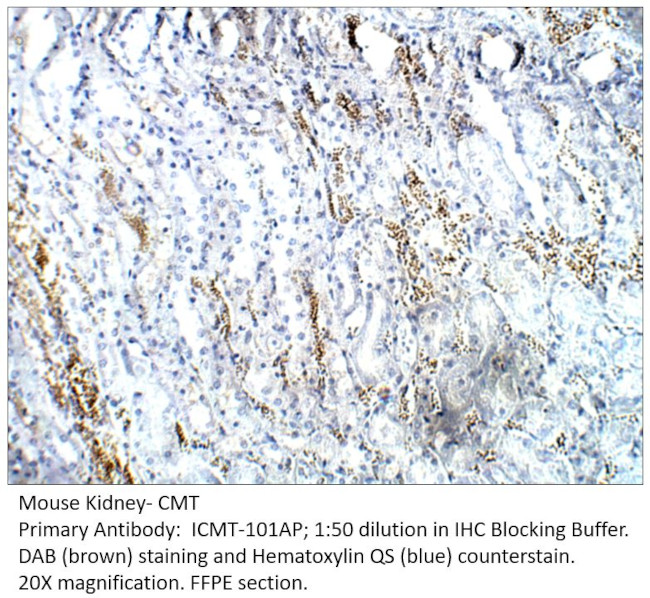 CMT Antibody in Immunohistochemistry (IHC)