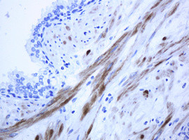 ICT1 Antibody in Immunohistochemistry (Paraffin) (IHC (P))