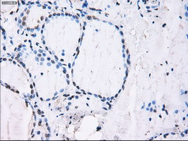 ID3 Antibody in Immunohistochemistry (Paraffin) (IHC (P))