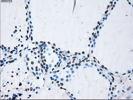 ID3 Antibody in Immunohistochemistry (Paraffin) (IHC (P))