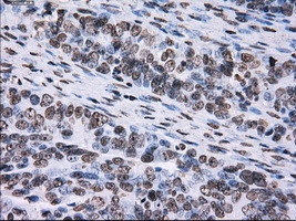 ID3 Antibody in Immunohistochemistry (Paraffin) (IHC (P))