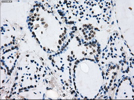 ID3 Antibody in Immunohistochemistry (Paraffin) (IHC (P))