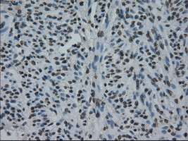 ID3 Antibody in Immunohistochemistry (Paraffin) (IHC (P))