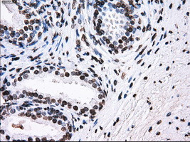 ID3 Antibody in Immunohistochemistry (Paraffin) (IHC (P))