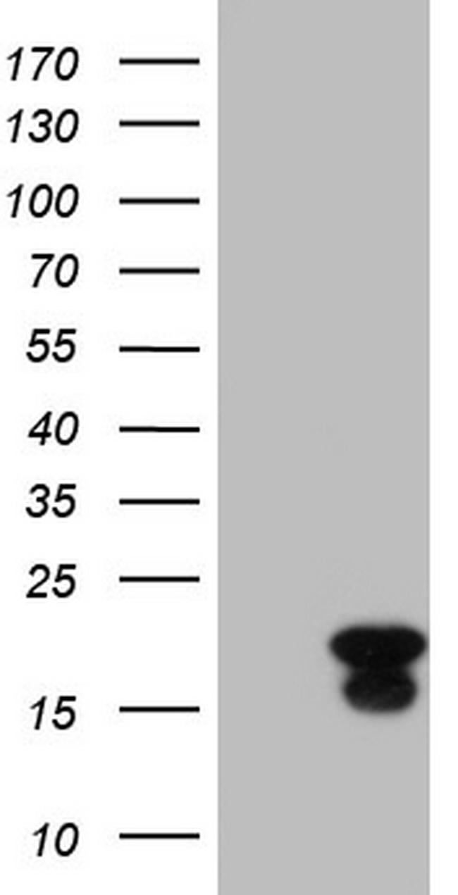 ID4 Antibody in Western Blot (WB)