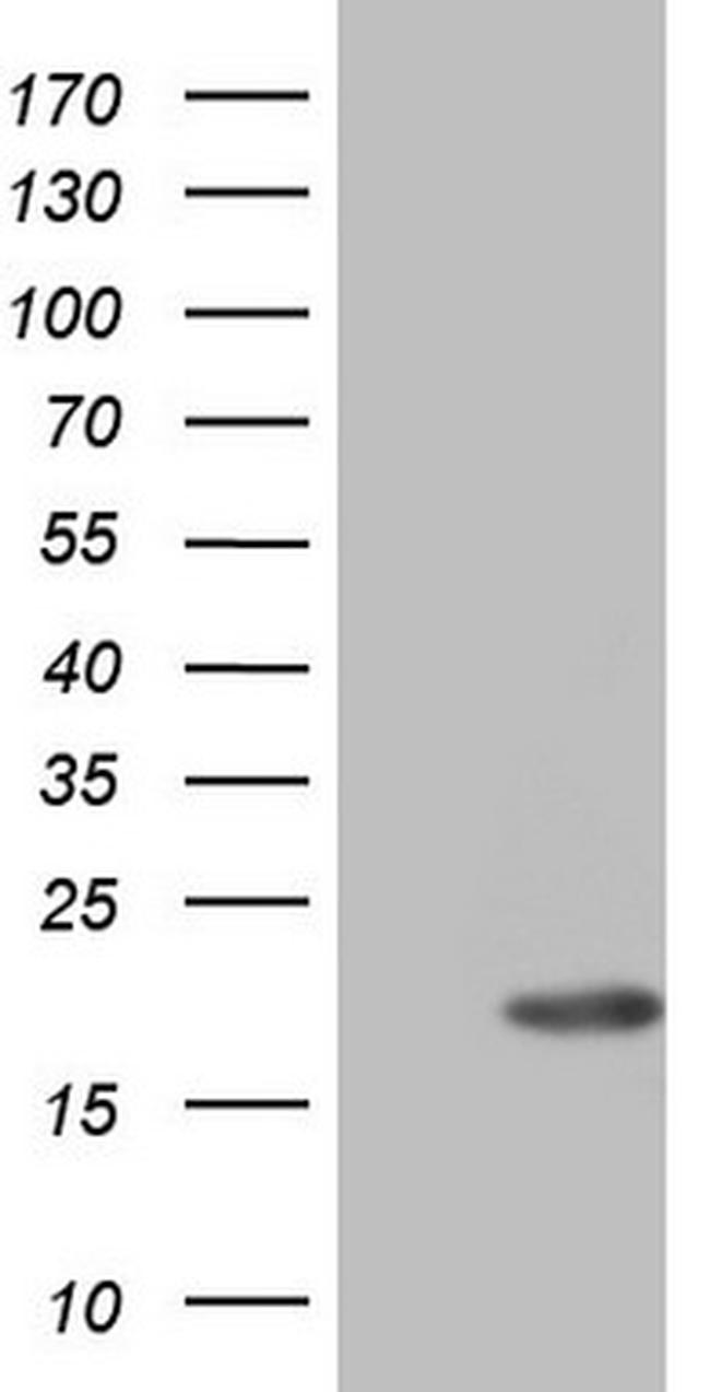 ID4 Antibody in Western Blot (WB)