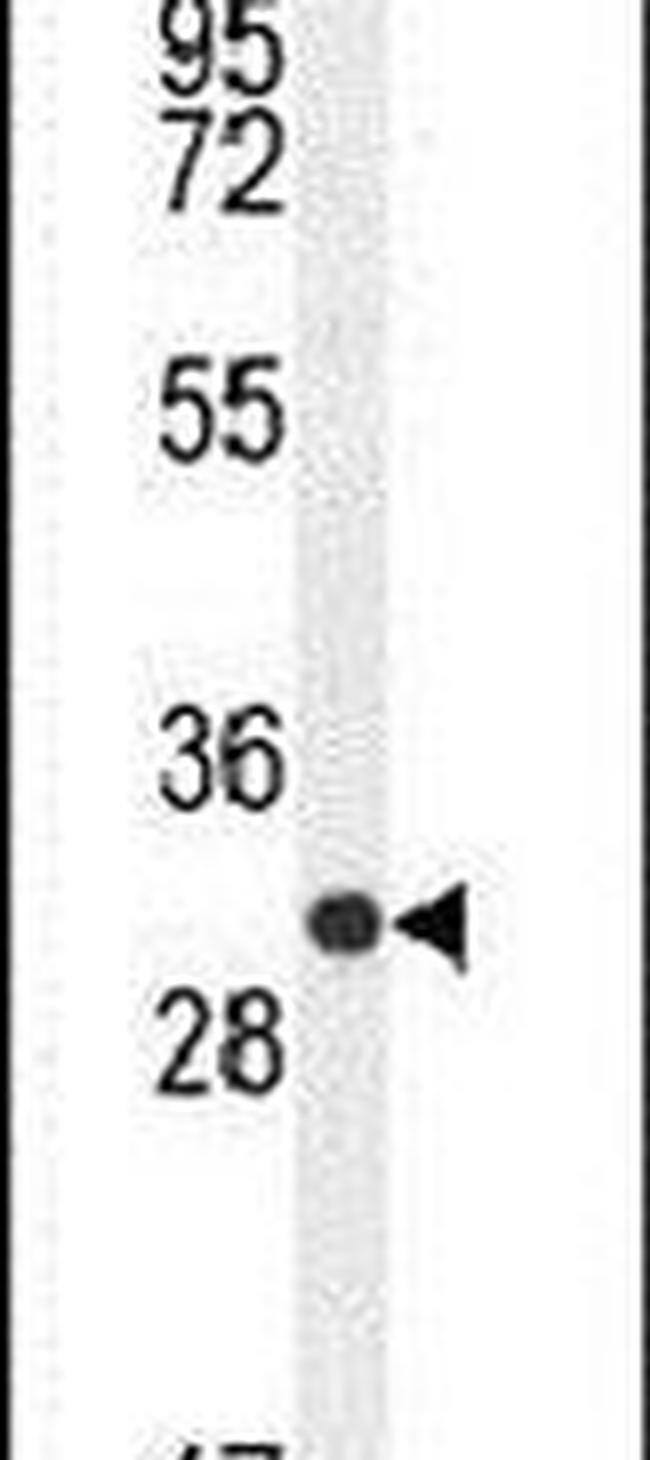 CTLA-4 Antibody in Western Blot (WB)