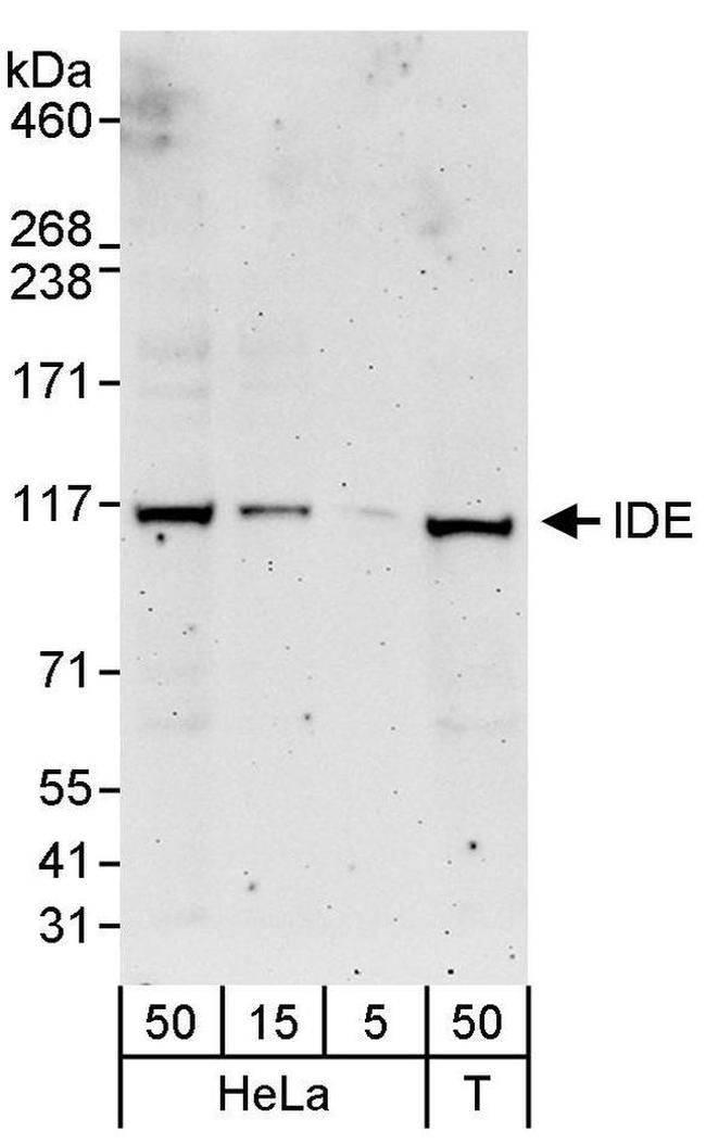 IDE Antibody in Western Blot (WB)