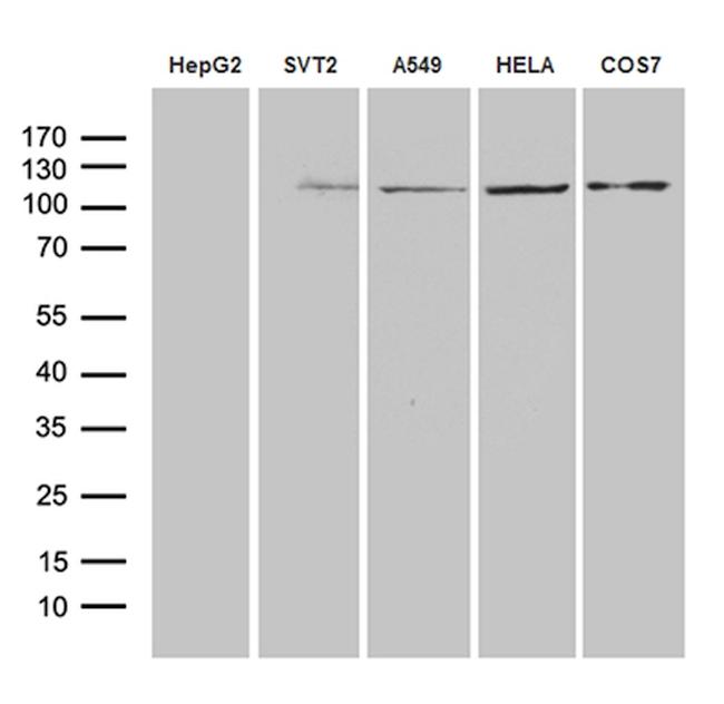 IDE Antibody in Western Blot (WB)