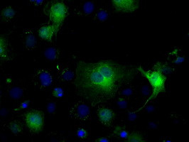 IDH1 Antibody in Immunocytochemistry (ICC/IF)