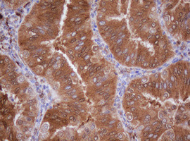 IDH1 Antibody in Immunohistochemistry (Paraffin) (IHC (P))