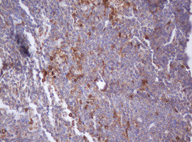 IDH1 Antibody in Immunohistochemistry (Paraffin) (IHC (P))