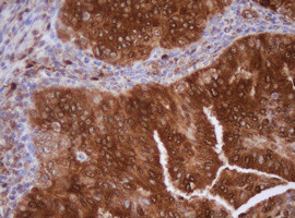 IDH1 Antibody in Immunohistochemistry (Paraffin) (IHC (P))