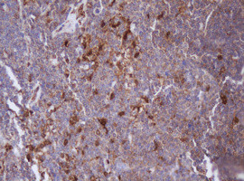 IDH1 Antibody in Immunohistochemistry (Paraffin) (IHC (P))