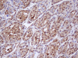 IDH1 Antibody in Immunohistochemistry (Paraffin) (IHC (P))