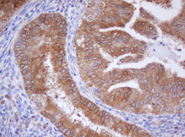 IDH1 Antibody in Immunohistochemistry (Paraffin) (IHC (P))