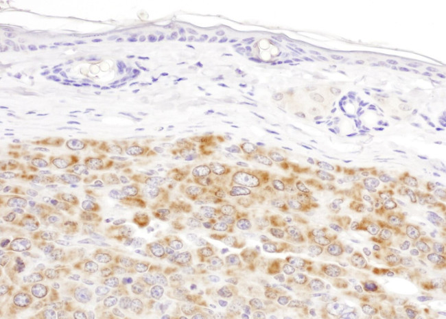 IDH2 Antibody in Immunohistochemistry (IHC)