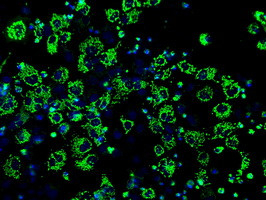 IDH3A Antibody in Immunocytochemistry (ICC/IF)