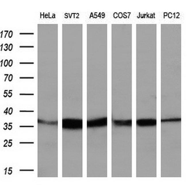 IDH3A Antibody in Western Blot (WB)