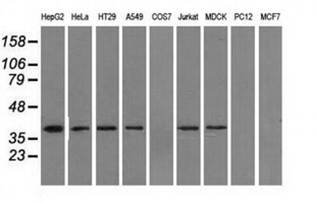 IDH3A Antibody in Western Blot (WB)