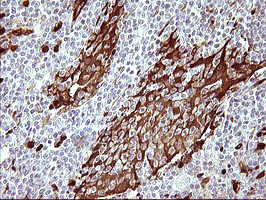 IDO1 Antibody in Immunohistochemistry (Paraffin) (IHC (P))