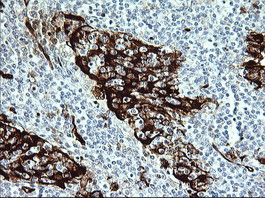 IDO1 Antibody in Immunohistochemistry (Paraffin) (IHC (P))