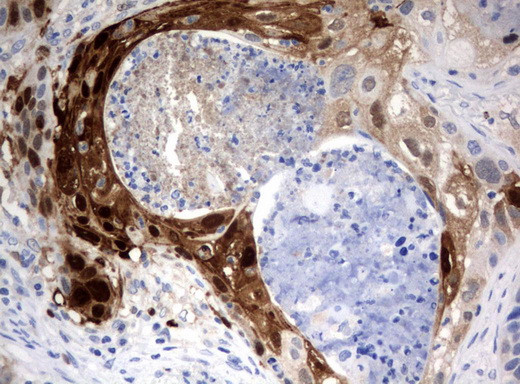 IDO1 Antibody in Immunohistochemistry (Paraffin) (IHC (P))