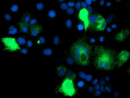 IDS Antibody in Immunocytochemistry (ICC/IF)