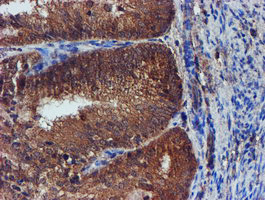 IDS Antibody in Immunohistochemistry (Paraffin) (IHC (P))