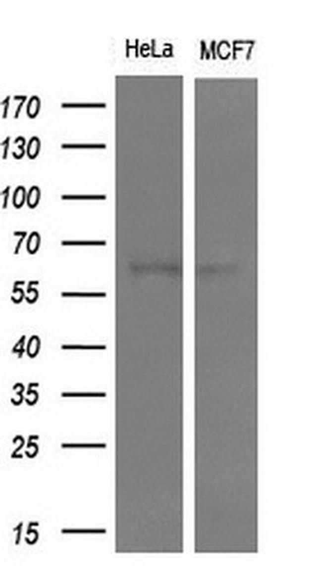 IDS Antibody in Western Blot (WB)