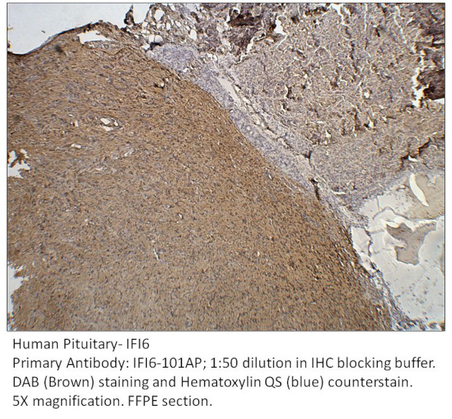 IFI6 Antibody in Immunohistochemistry (IHC)