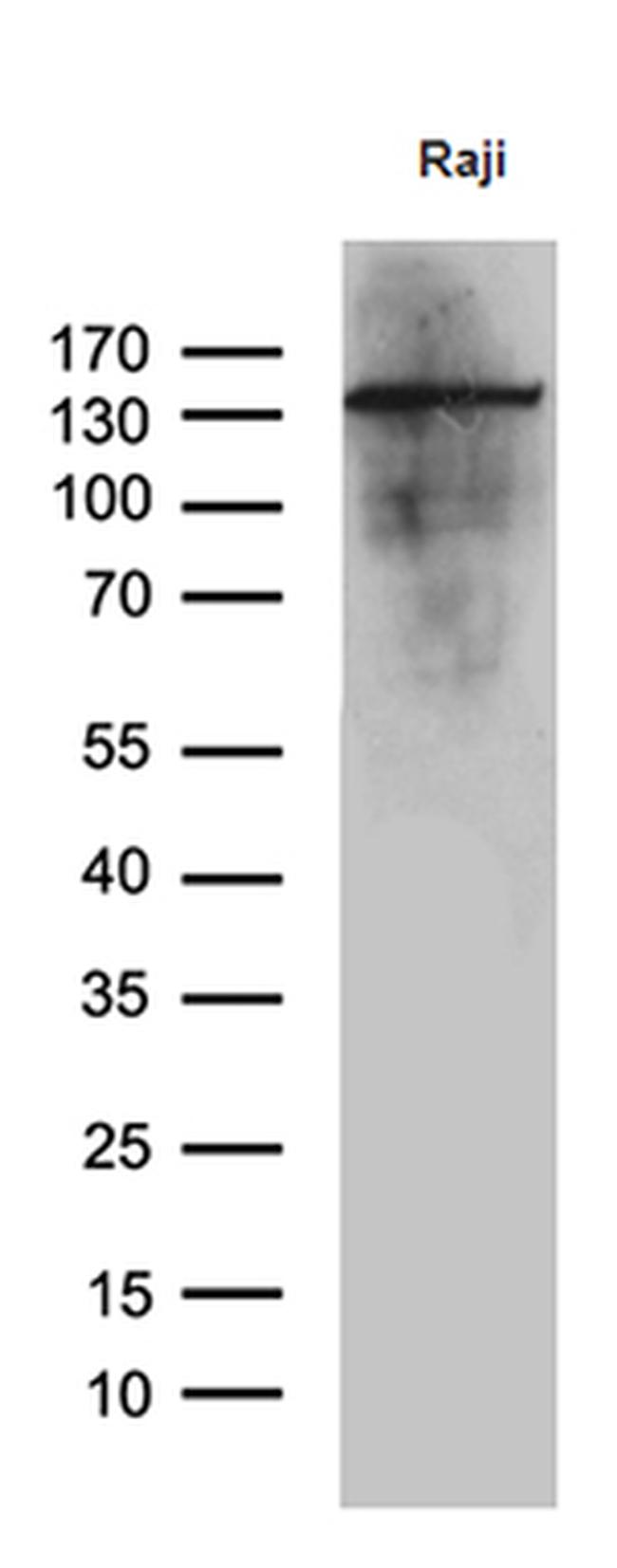 IFIH1 Antibody in Western Blot (WB)