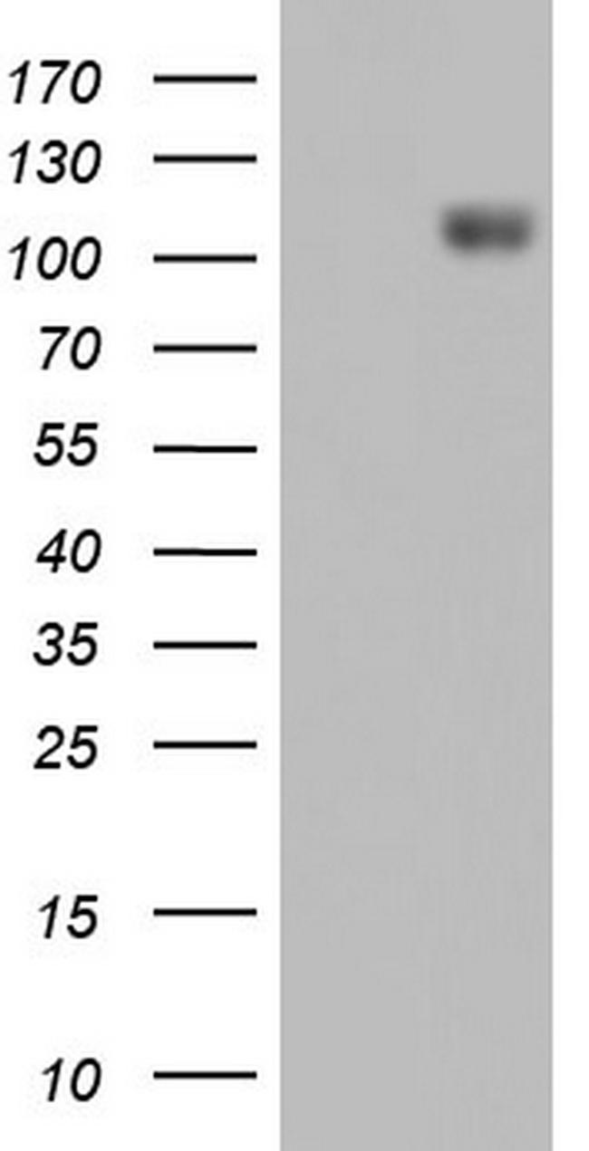 IFIH1 Antibody in Western Blot (WB)