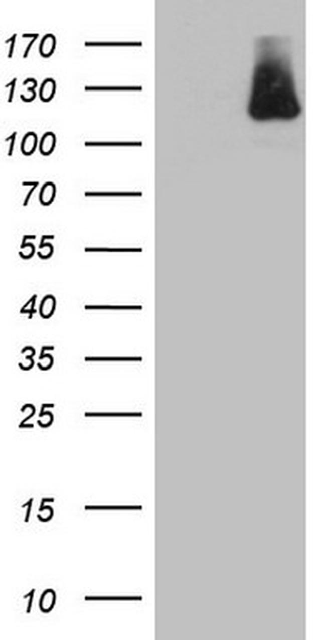 IFIH1 Antibody in Western Blot (WB)