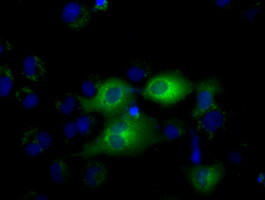 IFIT1 Antibody in Immunocytochemistry (ICC/IF)