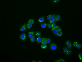 IFIT1 Antibody in Immunocytochemistry (ICC/IF)