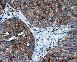 IFIT1 Antibody in Immunohistochemistry (Paraffin) (IHC (P))