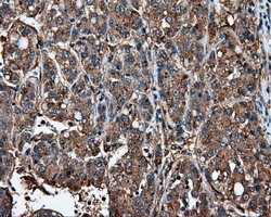 IFIT1 Antibody in Immunohistochemistry (Paraffin) (IHC (P))