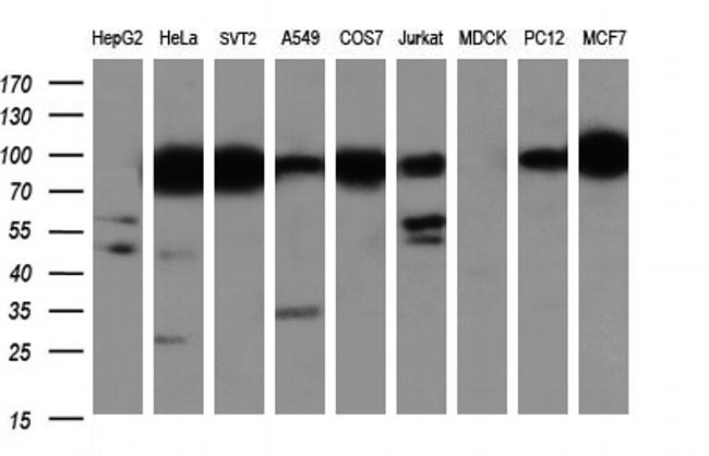 IFIT1 Antibody in Western Blot (WB)