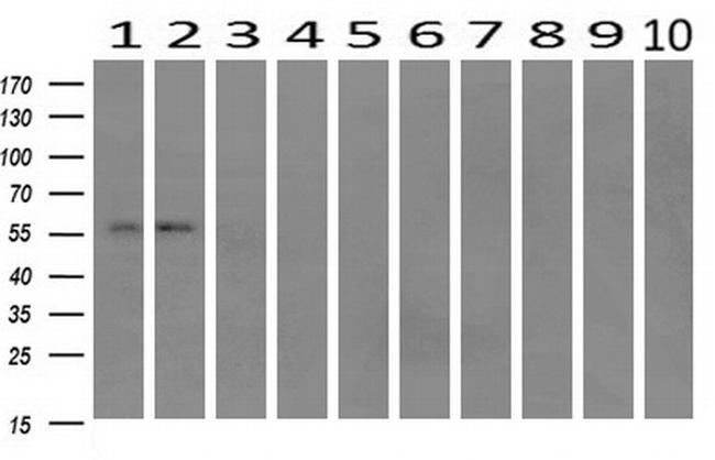 IFIT1 Antibody in Western Blot (WB)