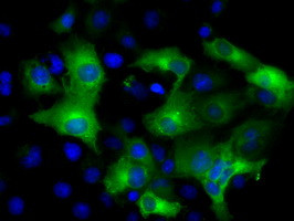 IFIT3 Antibody in Immunocytochemistry (ICC/IF)