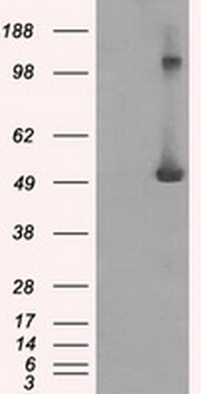 IFIT3 Antibody in Western Blot (WB)