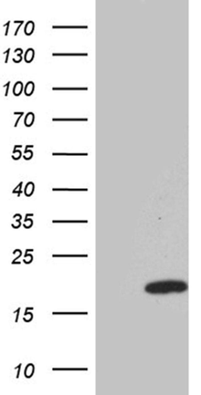 IFITM2 Antibody in Western Blot (WB)