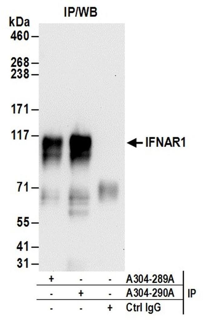 IFNAR1 Antibody in Western Blot (WB)