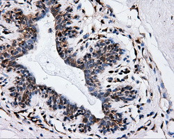 IFT57 Antibody in Immunohistochemistry (Paraffin) (IHC (P))