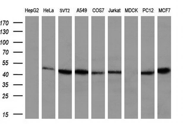 IFT57 Antibody in Western Blot (WB)