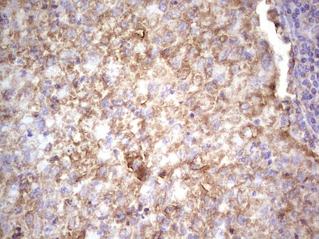 IGF1 Antibody in Immunohistochemistry (Paraffin) (IHC (P))