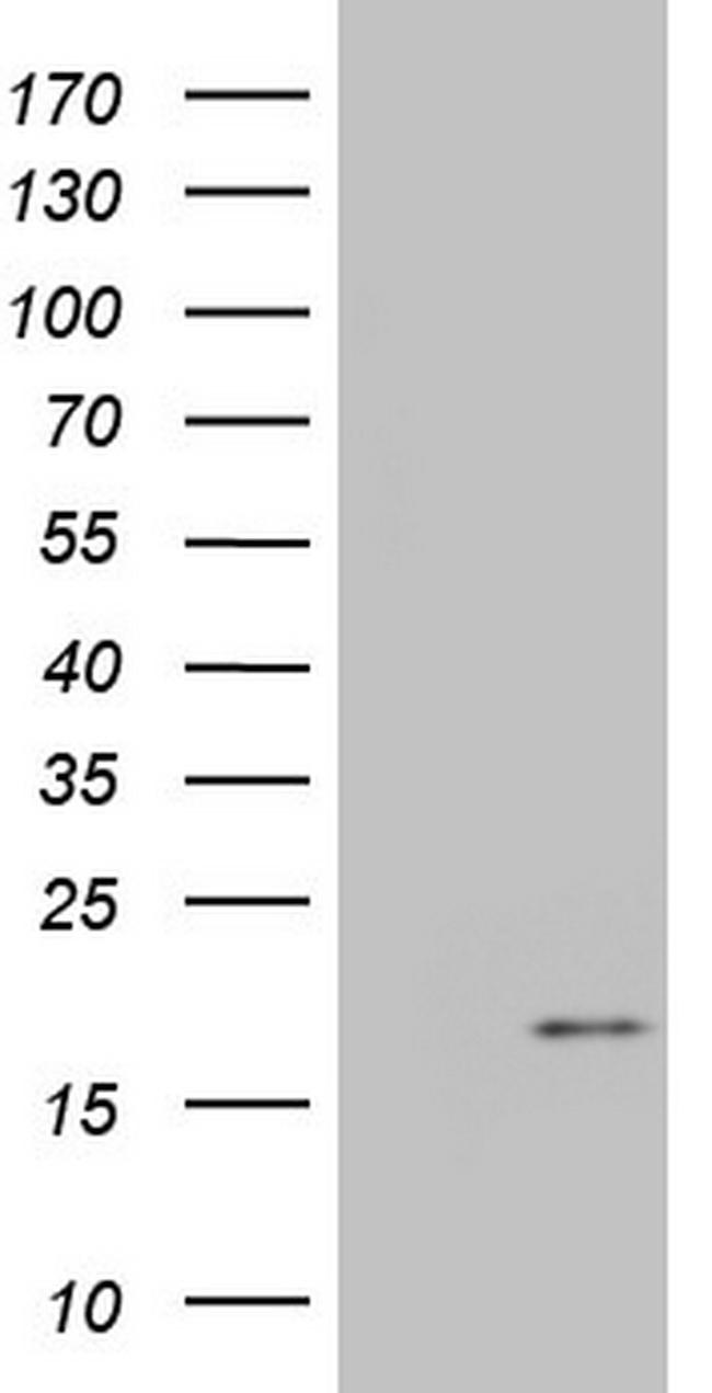 IGF1 Antibody in Western Blot (WB)